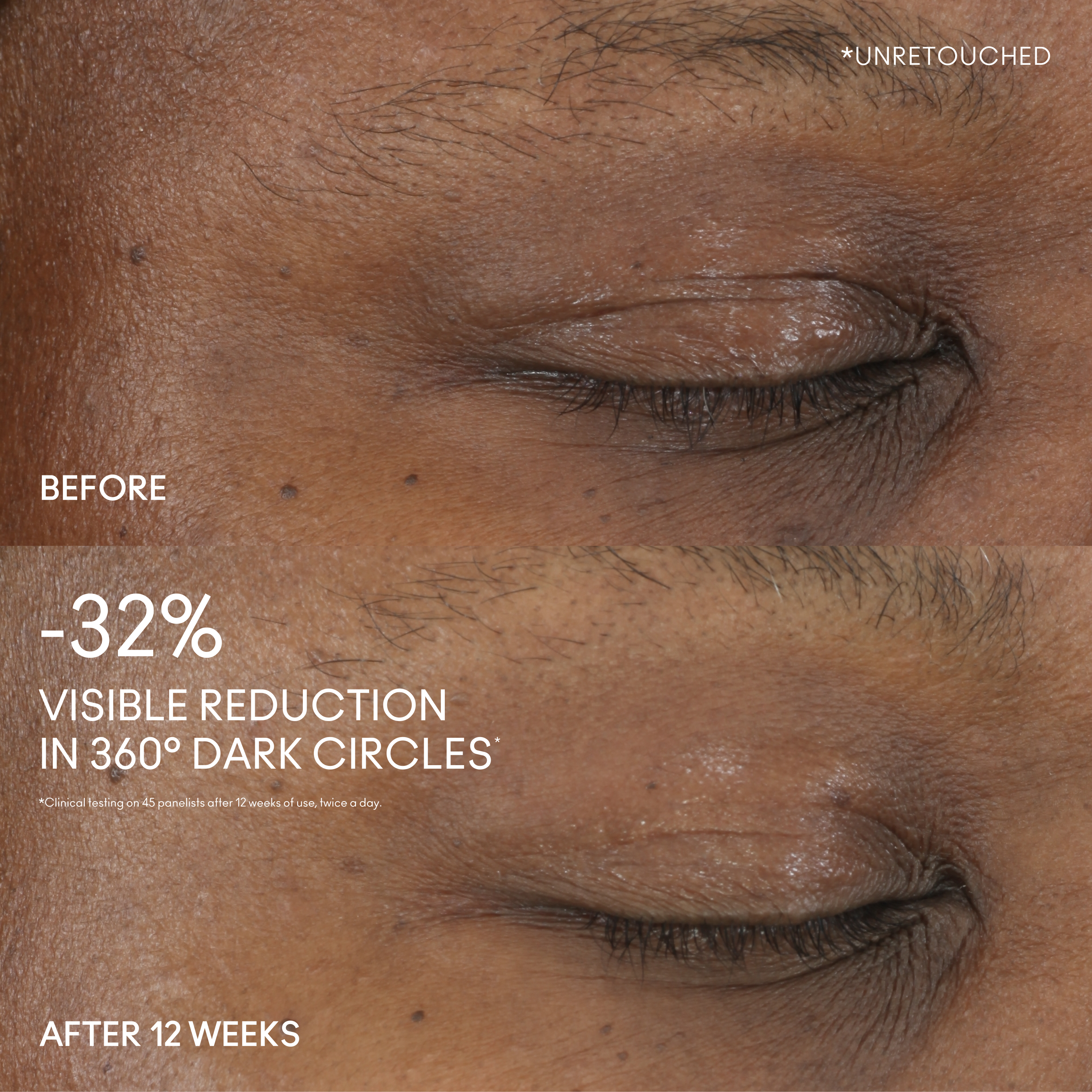 Hyper Real Serumizer™ Eye 360° Bright Eye Treatment - Polished Daily Care